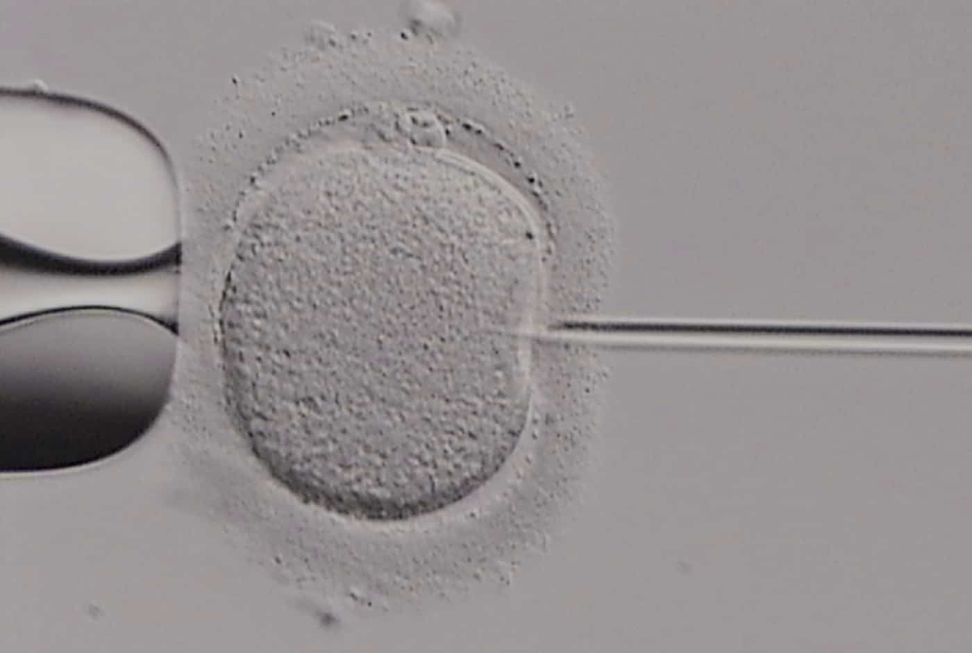 Are IVF and ICSI the same?